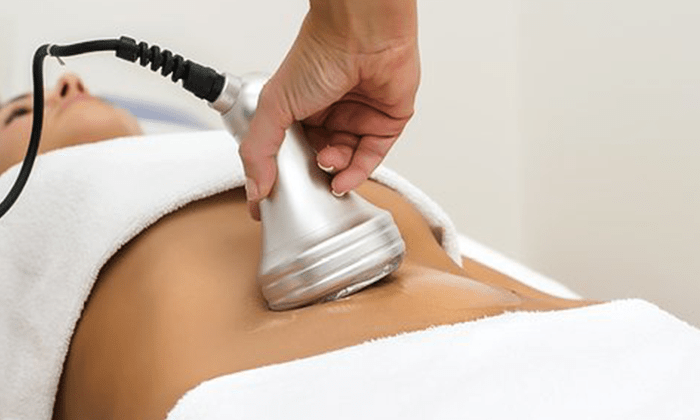 Ultrasound Cavitation body contouring